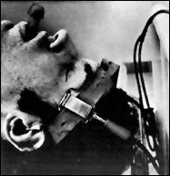 Electroshock