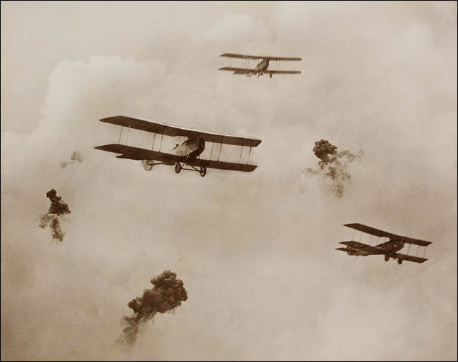 Frank Hurley: Shrapnel Damage